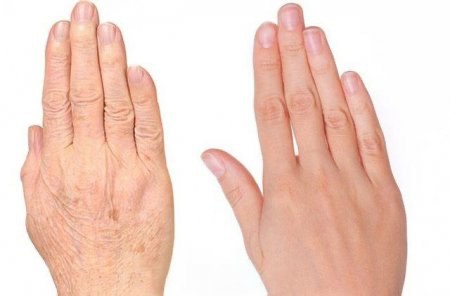Hình ảnh bàn tay trước và sau khi lão hóa