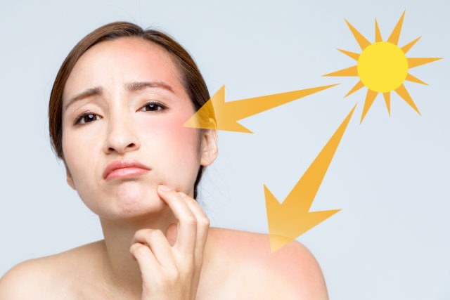 Chăm sóc da treatment khiến da nhạy cảm với ánh nắng, dễ sạm da và tăng sắc tố nếu không chống nắng kỹ