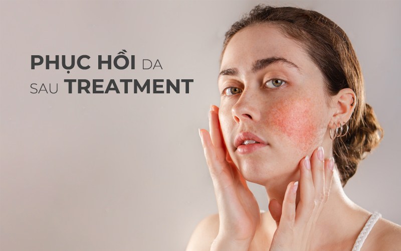 Phục hồi da sau treatment có thật sự cần thiết