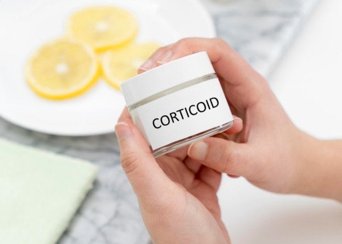 Hình ảnh minh họa corticoid là gì trong da liễu và mỹ phẩm