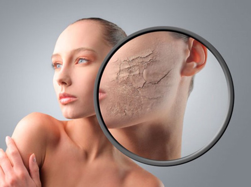 Da khô thiếu nước với các dấu hiệu bong tróc, xỉn màu cần cấp ẩm chuyên sâu